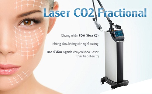 Điều trị sẹo rỗ bằng Laser hiệu quả