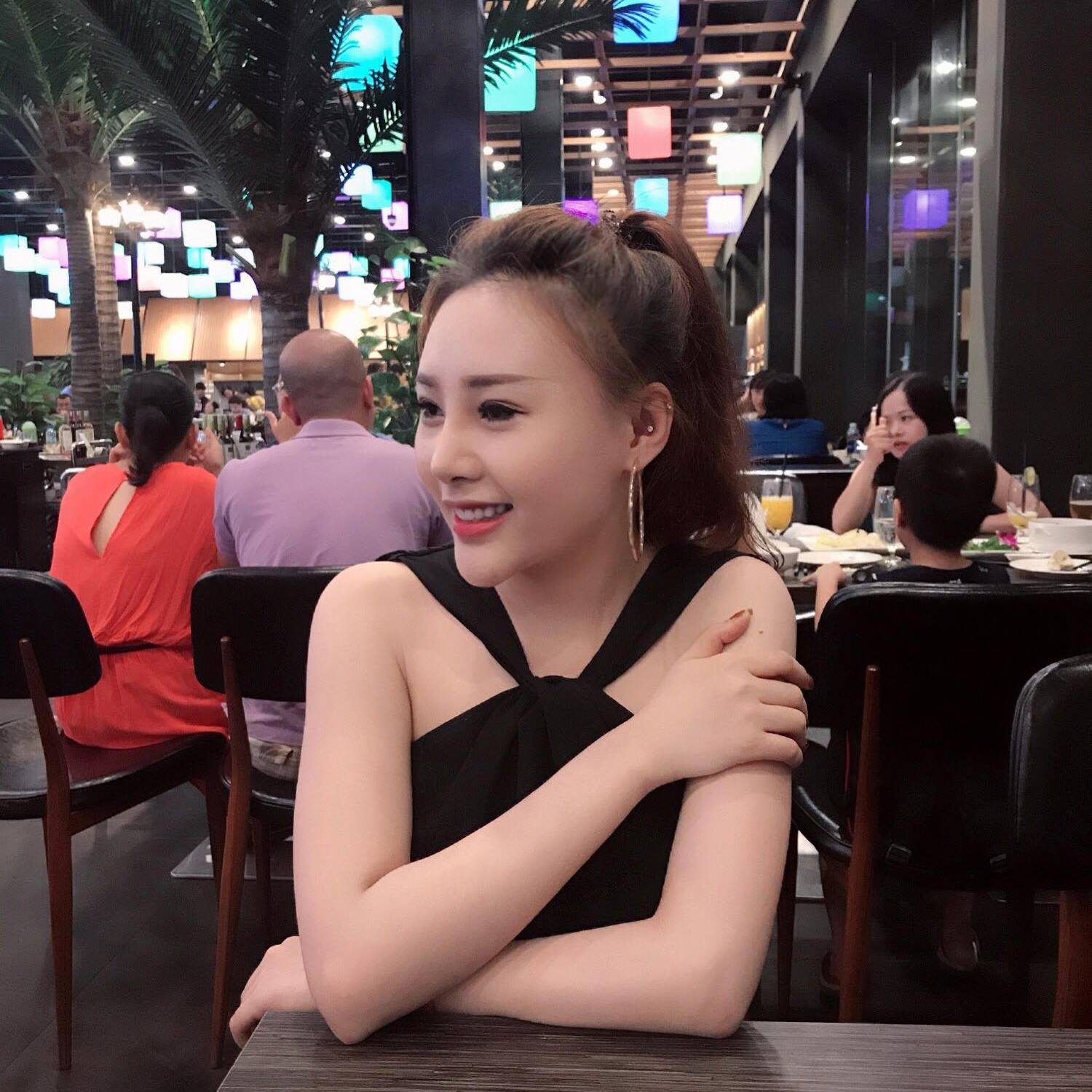 Hotgirl Thanh Tú (Tú Kẹo) – Sửa mũi cũ thành công