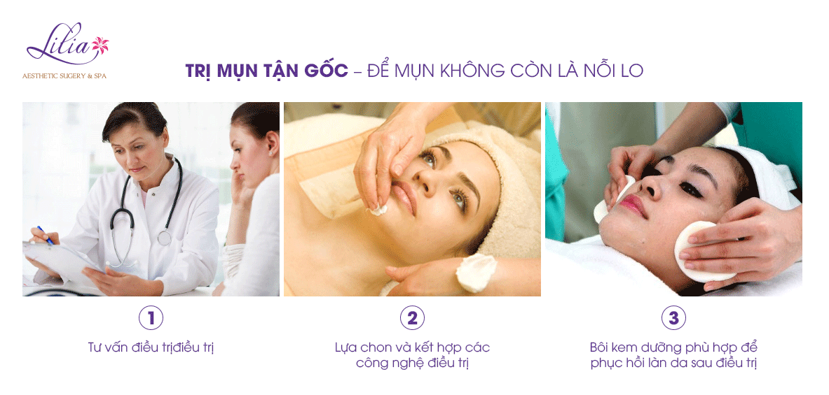 3b Trị mụn tận gốc
