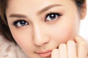lấy mỡ thừa mí mắt dưới có đau không