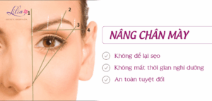 Nâng chân mày