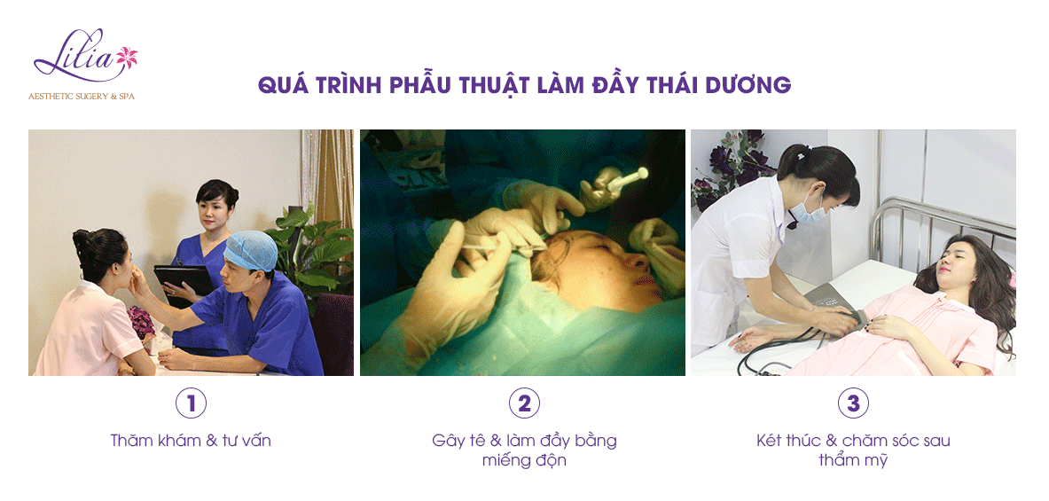 Làm đầy thái dương