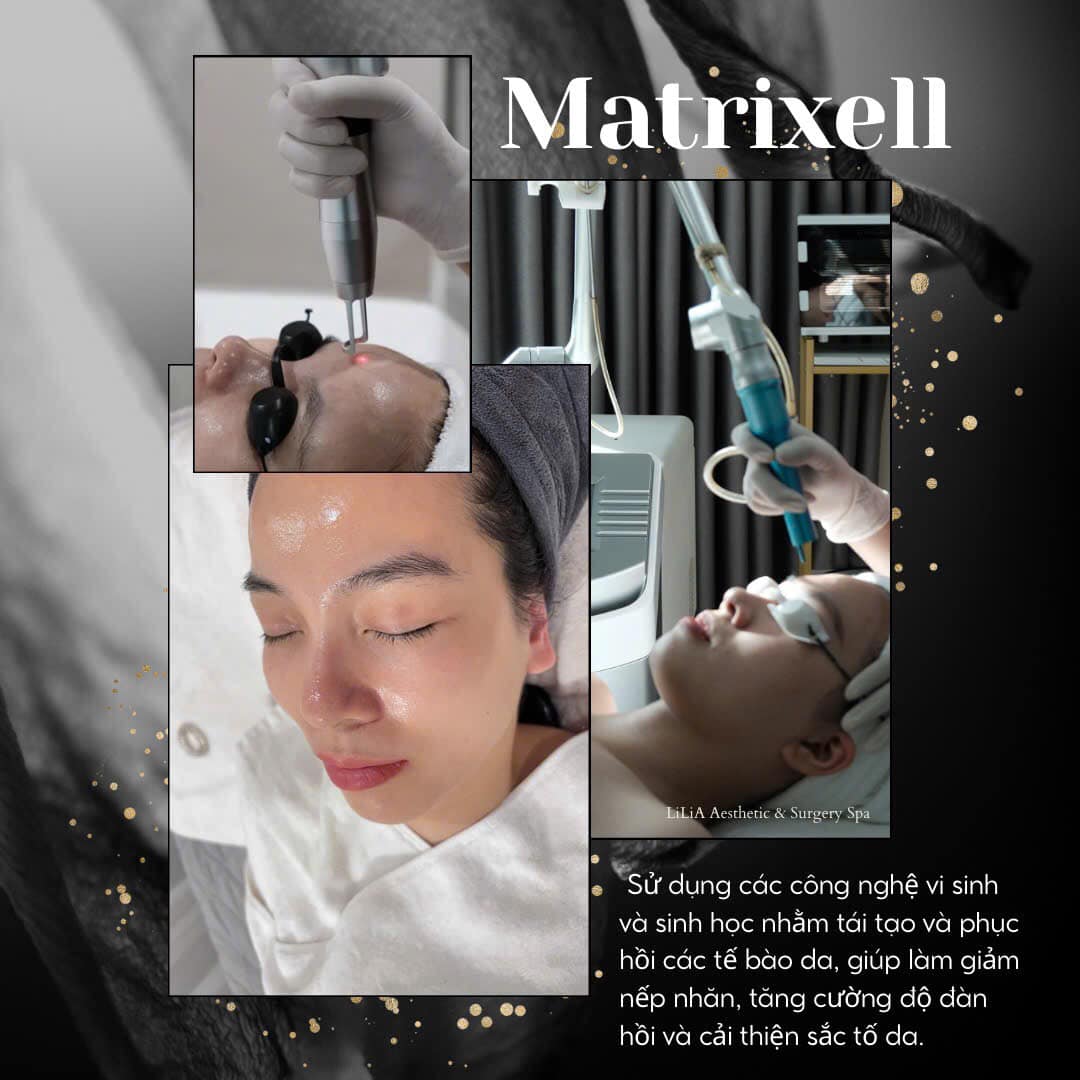 Trẻ hoá da, làm trắng da công nghệ Matrixell