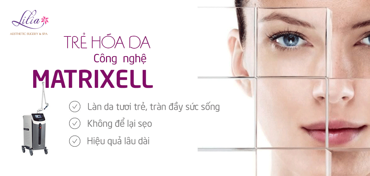 Ưu đãi Tháng 3 – Quà cho phái đẹp cùng Thẩm mỹ viện Lilia