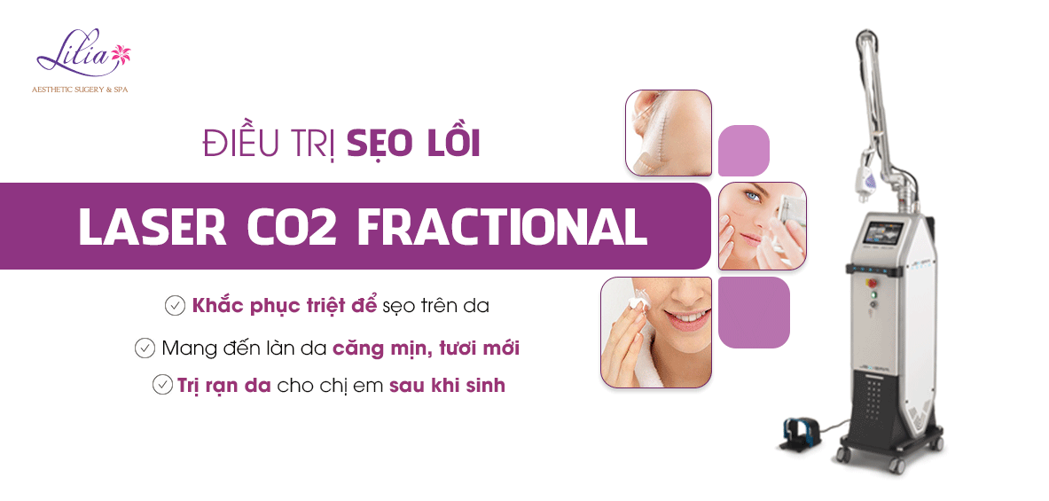 Phương pháp điều trị sẹo rỗ hiệu quả nhất 2016