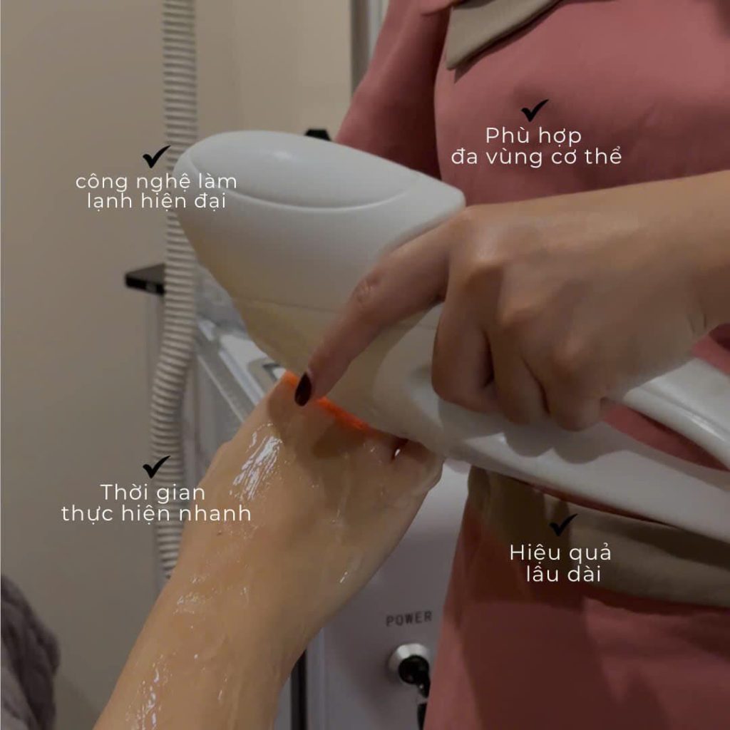 Ưu điểm của triệt lông lạnh DPL 
