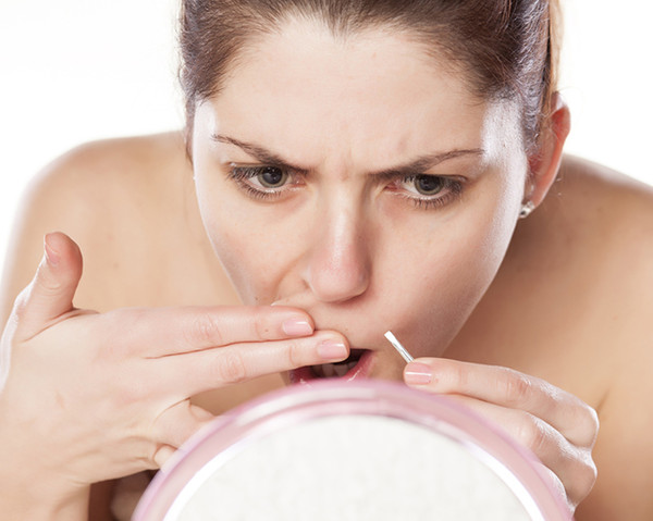 Triệt lông vùng mép vĩnh viễn ở đâu tốt?