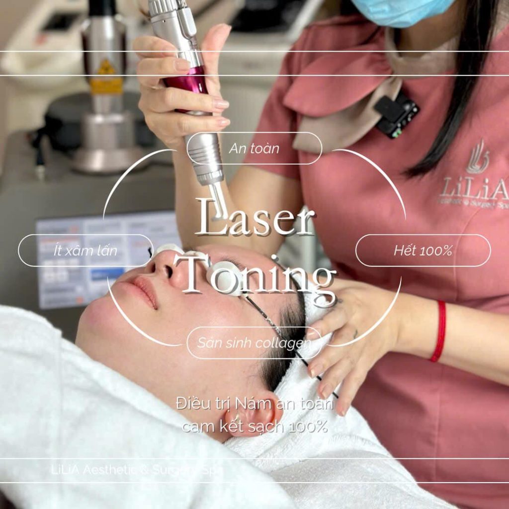 Laser Toning tại Thẩm mỹ viện LiliA